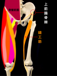 上前腸骨棘裂離骨折・上前腸骨棘剥離骨折―上前腸骨棘と縫工筋