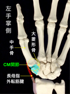第1中手骨基部骨折ーベンット骨折・ローランド骨折ーCM関節と長母指外転筋