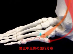 ジョーンズ骨折―第五中足骨の血行分布イメージ|住吉区長居藤田鍼灸整骨院
