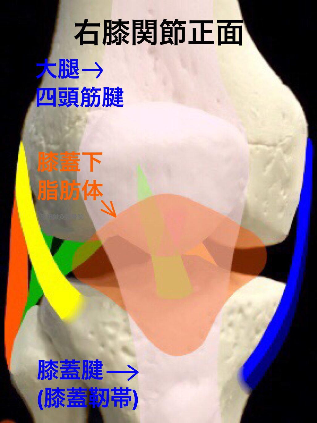 膝蓋下脂肪体炎（フォッファー病）－膝のお皿の下の腫れや痛み | 藤田鍼灸整骨院藤田鍼灸整骨院