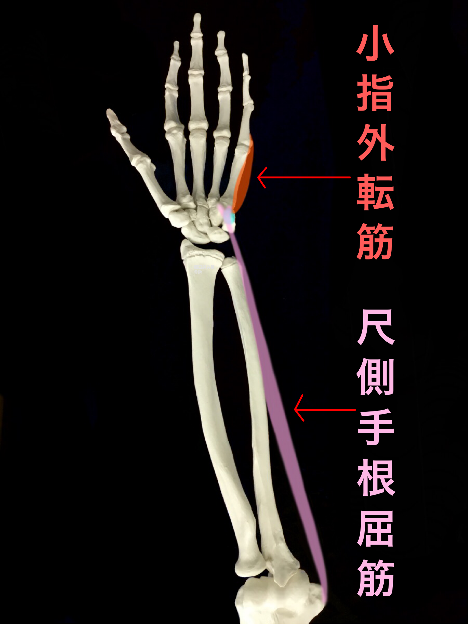 图2-3 腕部标志-外科学-医学