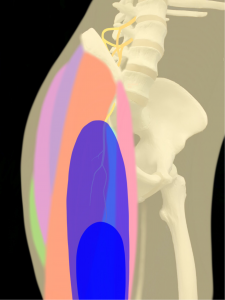 大腿外側皮神経痛の知覚障害部位|住吉区長居藤田鍼灸整骨院
